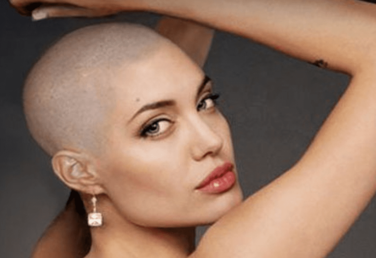 محاربات السرطان لستِ وحدك .. نجمات العالم تألقن برؤوس صلعاء | صور 