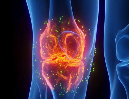 كشف علمي جديد قد يغير مستقبل علاج &laquo;هشاشة العظام&raquo;